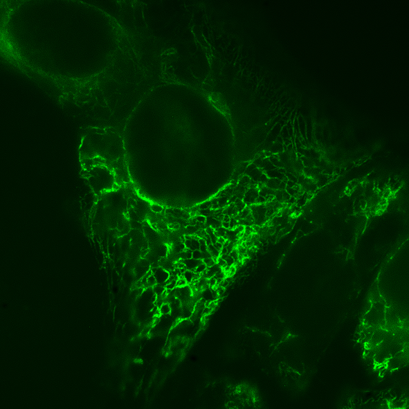 GFP-markiertes Zytokeratin