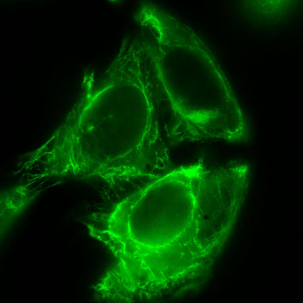 GFP-markiertes Zytokeratin